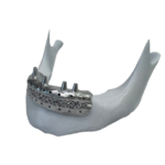 IMG removebg preview