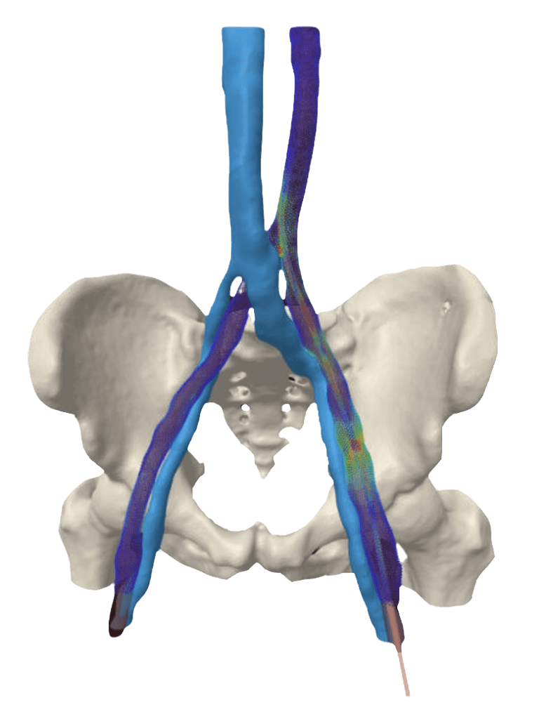 pelvis