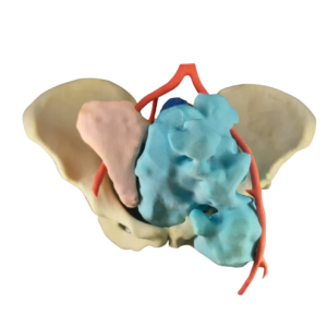 PELVIS