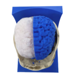 Brain Meningioma Resection Simulator